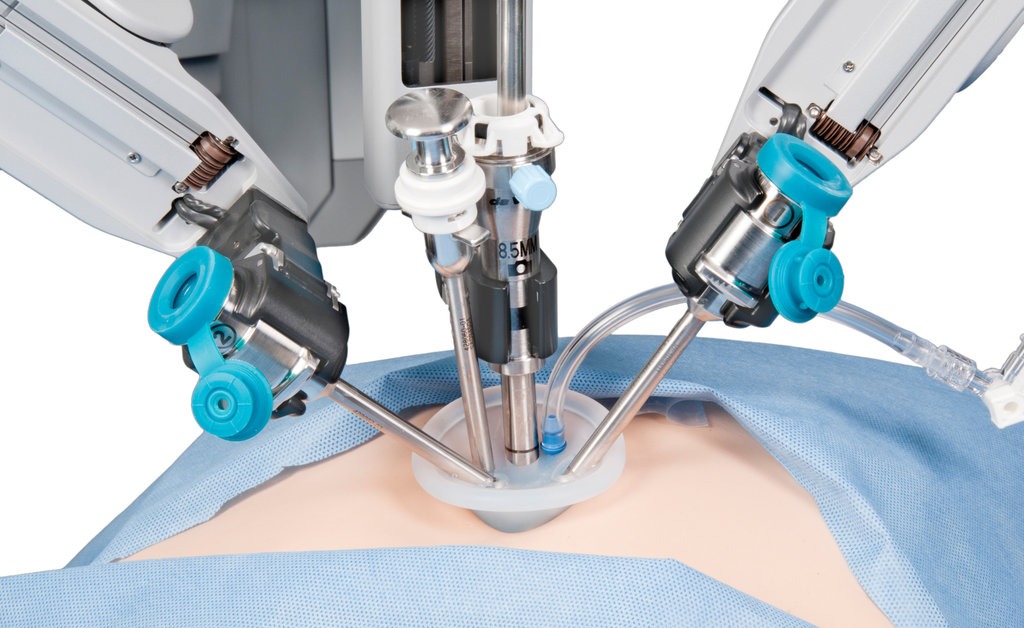 Best Robotic Spine Surgery Treatment in Delhi NCR