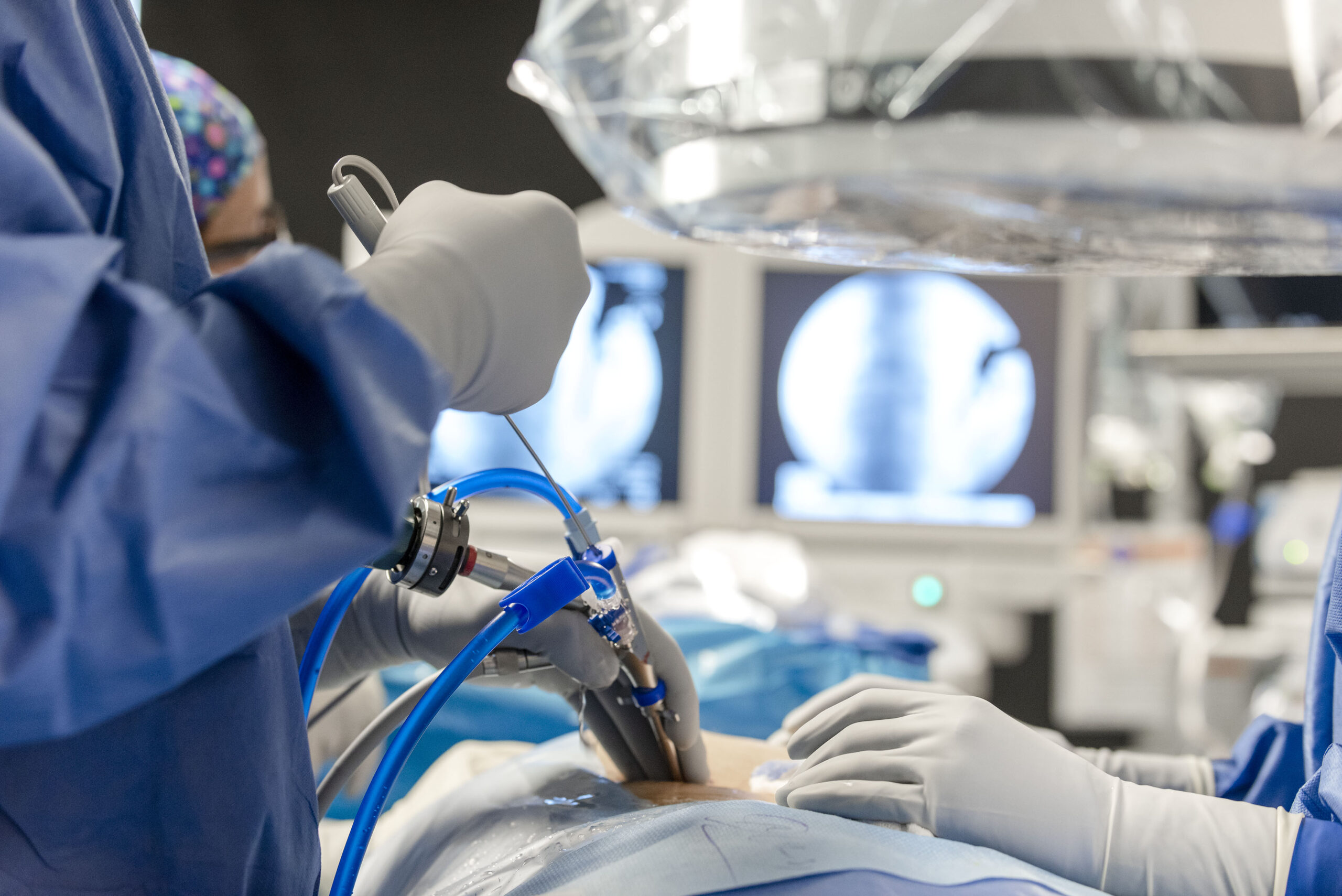 Endoscopic Spine Surgery Treatment in Delhi NCR | Dr. Sanyam Jain Endoscopic Spine Surgery Treatment in Delhi NCR | Dr. Sanyam Jain